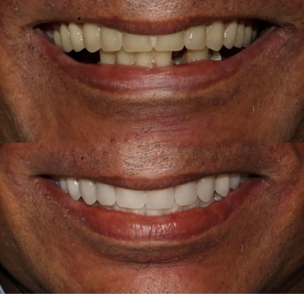 dep_antes_e_depois_4