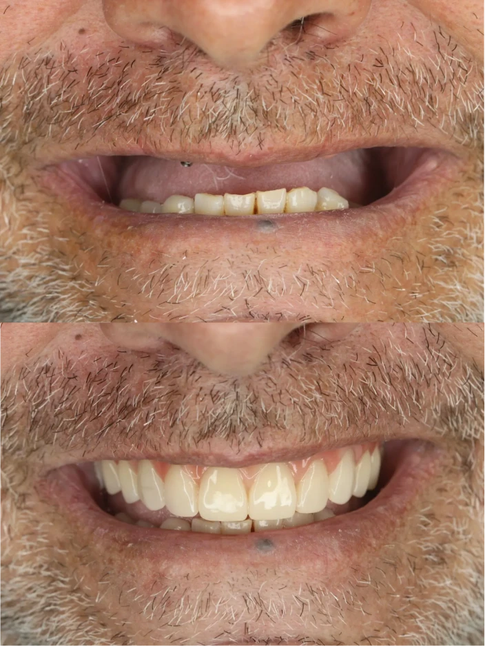 dep_antes_e_depois_6