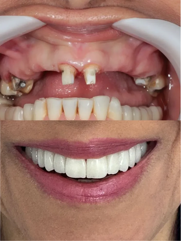 dep_antes_e_depois_7