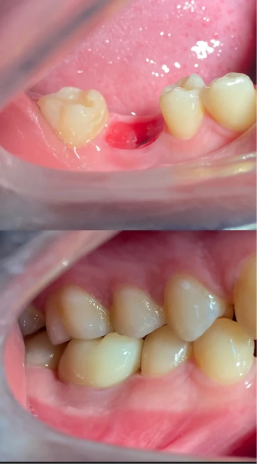 dep_antes_e_depois_8